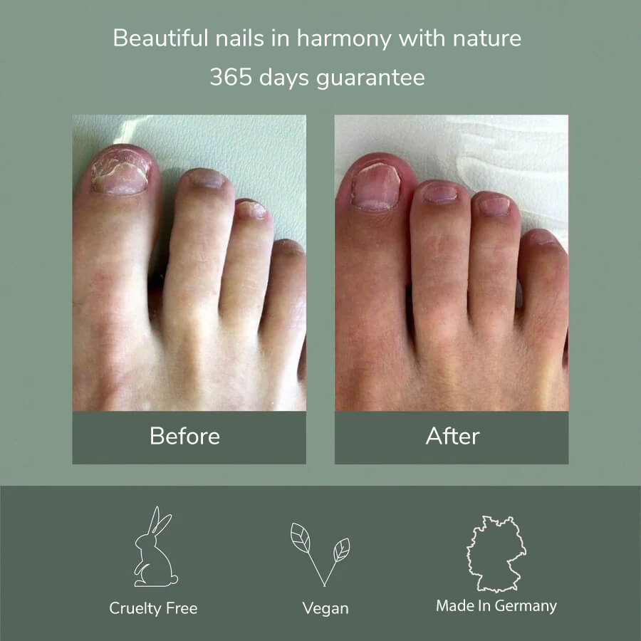 Pedi Pen